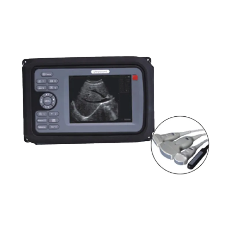 B Mode Ultrasonic Diagnostic Instruments