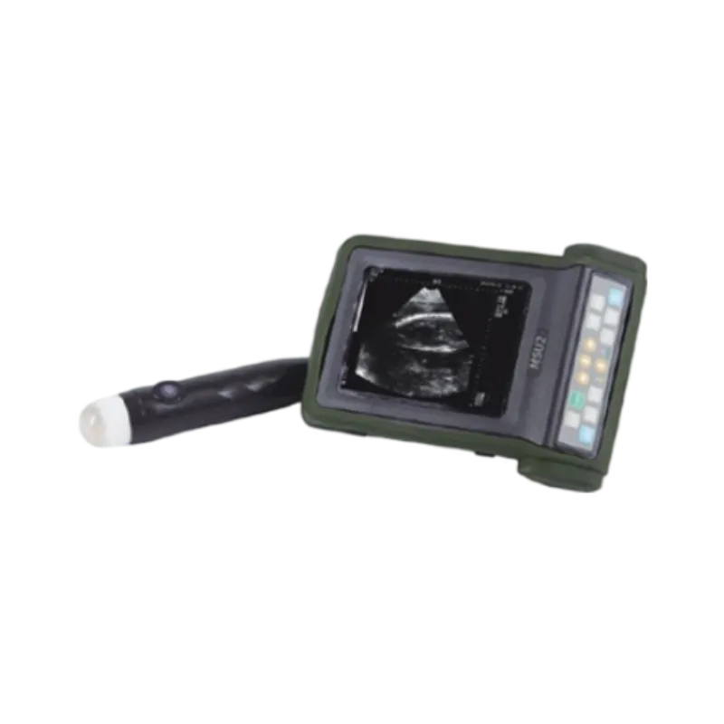 B Mode Ultrasonic Diagnostic Instruments